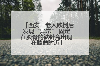 西安一老人跌倒后发现“异常” 固定在股骨的钛针竟出现在膝盖附近
